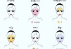 Skin Types